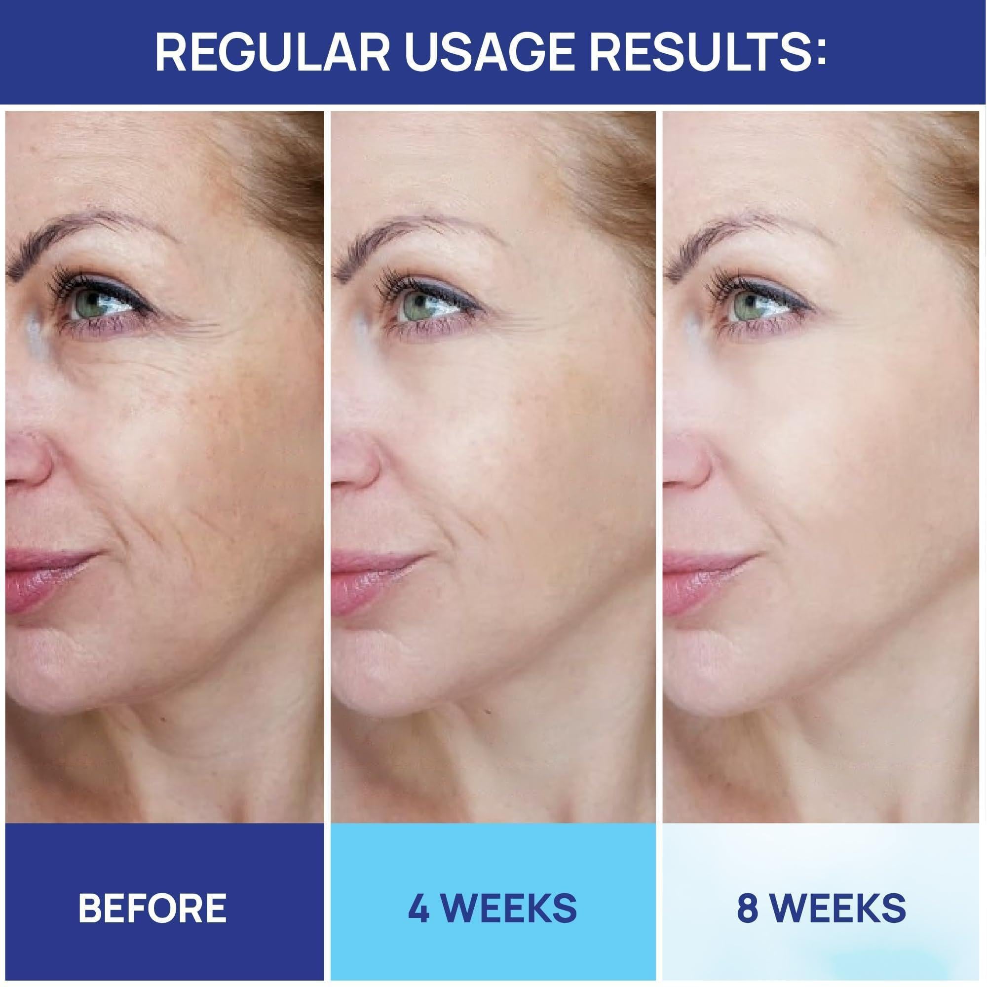 Retinol Cream for Face Collagen and Retinol Moisturizer with Hyaluronic Acid Retinol Cream for Face Collagen and Retinol Moisturizer with Hyaluronic Acid