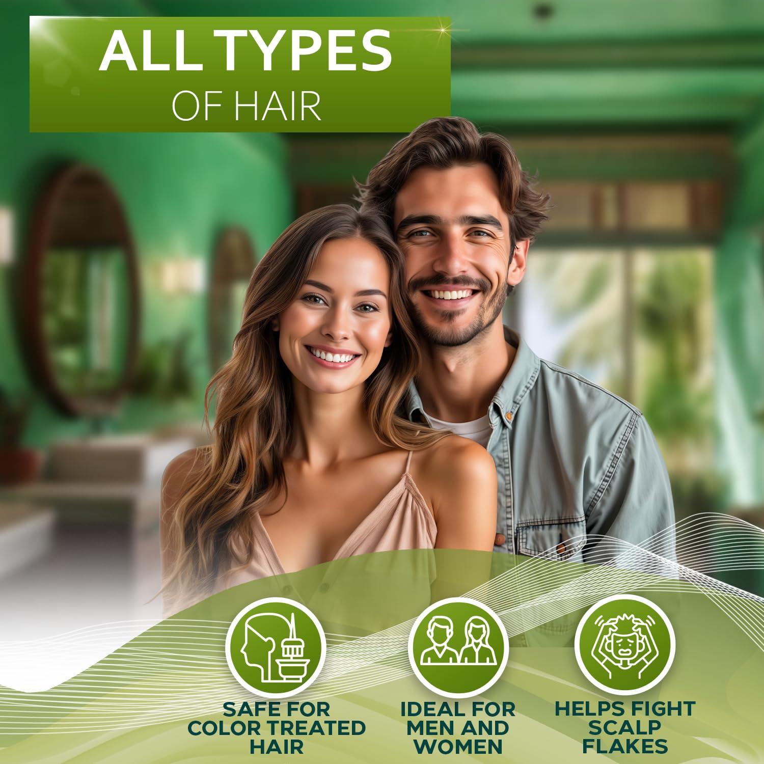Onion Shampoo and Conditioner Set With Rosemary and Biotin Thickening Products Onion Shampoo and Conditioner Set With Rosemary and Biotin Thickening Products