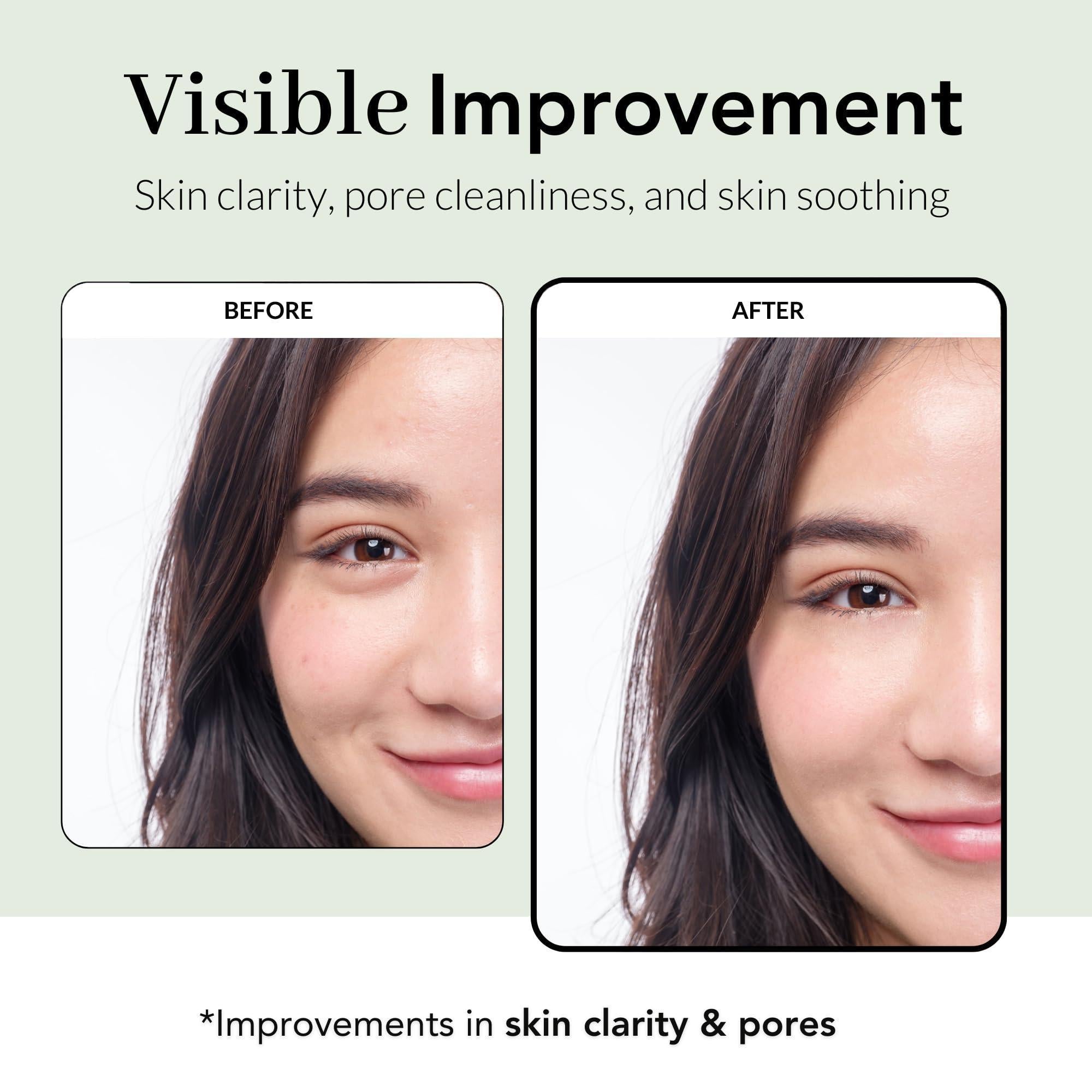 Tea Tree Wrapping Mask Skin Soothing care Acne prone Skin 2.4 Oz Teatree & 6 Tropical Fruit Extracts Calming Peel Off Mask Korean Skincare for Face Tea Tree Wrapping Mask Skin Soothing care Acne prone Skin 2.4 Oz Teatree & 6 Tropical Fruit Extracts Calming Peel Off Mask Korean Skincare for Face