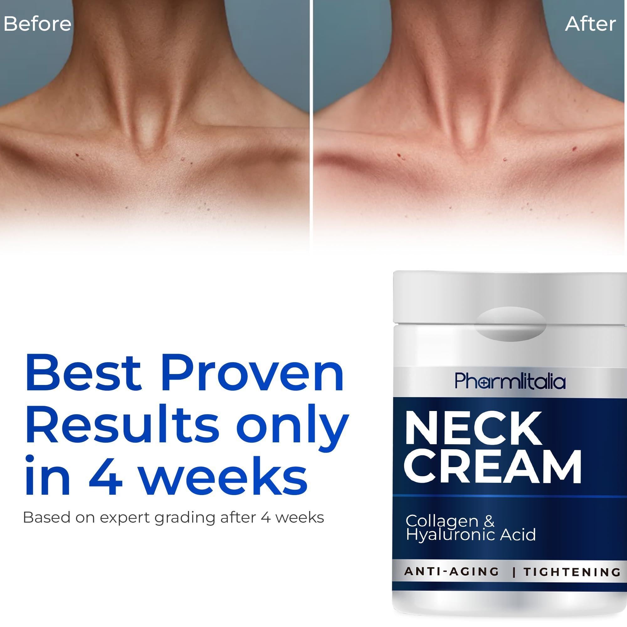 Neck Firming and Tightening Cream with Collagen Hyaluronic Acid Anti Age 4 Fl oz Neck Firming and Tightening Cream with Collagen Hyaluronic Acid Anti Age 4 Fl oz