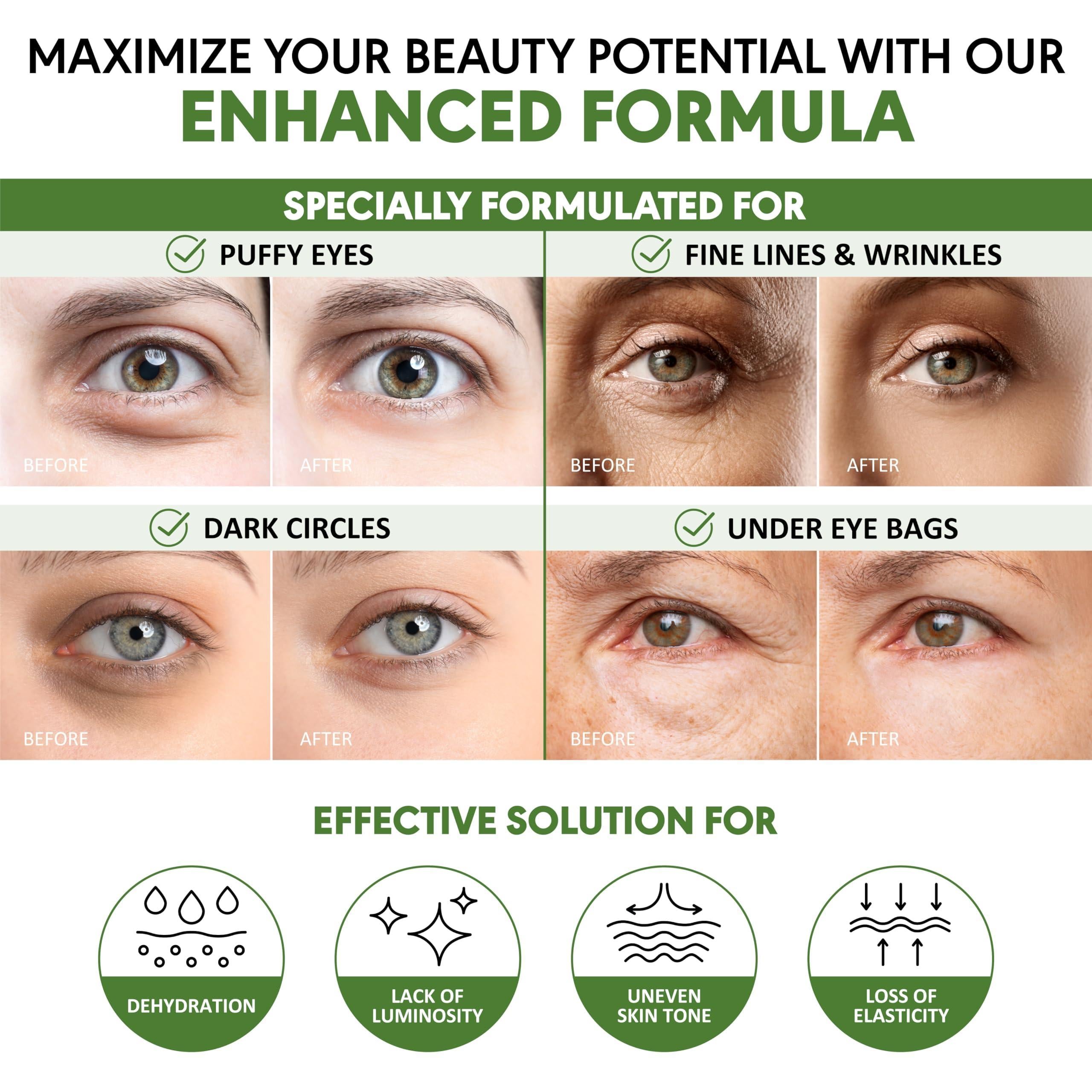 Green Tea Under Eye Patches for Wrinkles and Eye Bags 30 Pairs Eye Masks for Green Tea Under Eye Patches for Wrinkles and Eye Bags 30 Pairs Eye Masks for